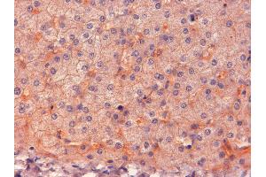 ABIN185487 (2µg/ml) staining of paraffin embedded Human Liver. (ENPP1 Antikörper  (C-Term))