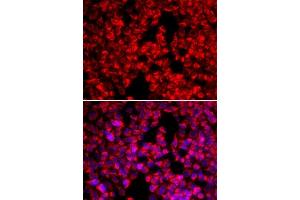 Immunofluorescence analysis of U20S cell using MTTP antibody. (MTTP Antikörper  (AA 1-130))