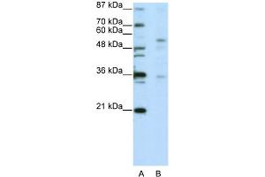 WB Suggested Anti-ZNF57 Antibody Titration:  5. (ZFP57 Antikörper  (C-Term))