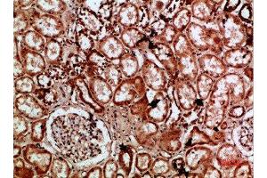 Immunohistochemical analysis of paraffin-embedded human-kidney, antibody was diluted at 1:200 (IMP3 Antikörper  (AA 135-184))