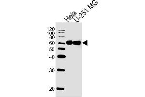 Lane 1: HeLa Cell lysates, Lane 2: U-251 MG Cell lysates, probed with FUBP3 (1216CT820. (FUBP3 Antikörper)