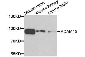 Western blot analysis of extracts of various cell lines, using ADAM15 antibody. (ADAM15 Antikörper)