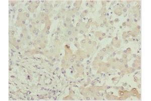 Immunohistochemistry of paraffin-embedded human liver tissue using ABIN7143434 at dilution of 1:100 (ADPGK Antikörper  (AA 218-497))