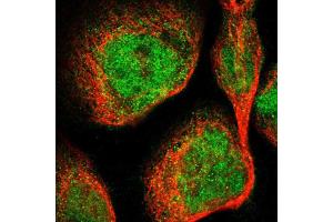 Immunofluorescent staining of A-431 cells using DGKE polyclonal antibody  shows positivity in cytoplasm and nucleus (green) but excluded from the nucleoli. (DGKE Antikörper  (AA 63-192))