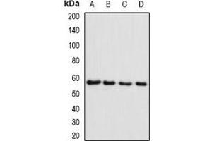 Western blot analysis of SMYD1 expression in Raji (A), MCF7 (B), mouse skeletal muscle (C), rat heart (D) whole cell lysates. (SMYD1 Antikörper)
