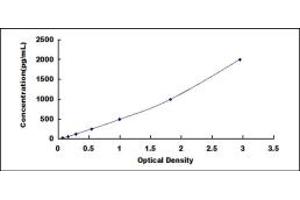 CEA ELISA Kit