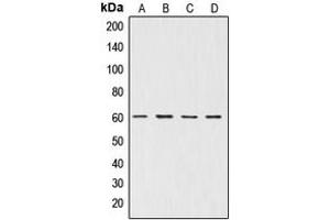 Western blot analysis of AKT expression in A549 (A), NIH3T3 (B), mouse brain (C), rat brain (D) whole cell lysates. (AKT1 Antikörper  (Center))