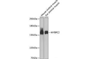 Western blot analysis of extracts of various cell lines using MYBPC2 Polyclonal Antibody at dilution of 1:1000. (MYBPC2 Antikörper)