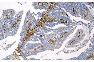 IHC analysis of Caveolin-1/CAV1 using anti-Caveolin-1/CAV1 antibody (ABIN6719534).