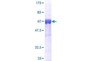 CrkL Protein (AA 1-303) (GST tag)