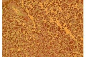 Immunohistochemistry (IHC) image for anti-Chemokine (C-C Motif) Receptor 4 (CCR4) (AA 17-39) antibody (ABIN2478968) (CCR4 Antikörper  (AA 17-39))