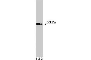 Western blot analysis of MST1 on a Jurkat cell lysate (Human T-cell leukemia, ATCC TIB-152). (MST1 Antikörper  (AA 331-483))