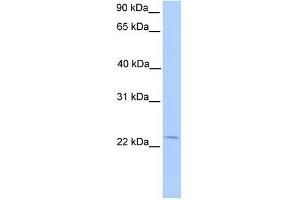 C5ORF39 antibody used at 1 ug/ml to detect target protein.