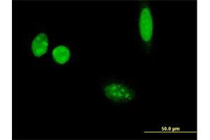 Immunofluorescence of purified MaxPab antibody to THSD3 on HeLa cell. (Isthmin 2 Antikörper  (AA 1-483))