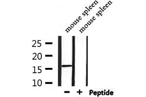 Western blot analysis of extracts from mouse spleen, using Substance P Antibody.