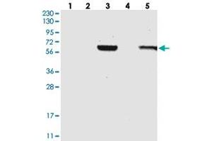 Western blot analysis of Lane 1: RT-4, Lane 2: U-251 MG, Lane 3: Human Plasma, Lane 4: Liver, Lane 5: Tonsil with C1RL polyclonal antibody . (C1RL Antikörper)