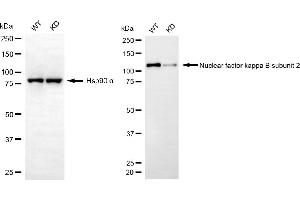 Western blotting analysis using nuclear factor kappa B subunit 2 antibody (ABIN7799635). (Rekombinanter NFkB Antikörper  (Subunit 2))