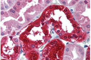 Human Kidney (formalin-fixed, paraffin-embedded) stained with CA2 antibody ABIN305738 at 5 ug/ml followed by biotinylated goat anti-rabbit IgG secondary antibody ABIN481713, alkaline phosphatase-streptavidin and chromogen. (CA2 Antikörper  (HRP))