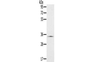 Western Blotting (WB) image for anti-NADH Dehydrogenase (Ubiquinone) 1 alpha Subcomplex, 9, 39kDa (NDUFA9) antibody (ABIN2423847) (NDUFA9 Antikörper)