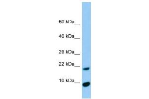Host:  Rabbit  Target Name:  Timm17a  Sample Type:  Rat Pancreas lysates  Antibody Dilution:  1. (TIMM17A Antikörper  (N-Term))