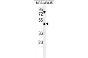 Western blot analysis of FBXL2 Antibody in MDA-MB435 cell line lysates (35ug/lane) (FBXL2 Antikörper  (C-Term))