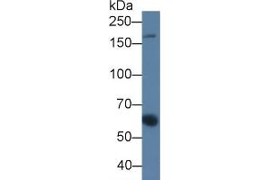 Detection of a2M in Porcine Serum using Monoclonal Antibody to Alpha-2-Macroglobulin (a2M) (alpha 2 Macroglobulin Antikörper  (AA 616-856))