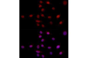 Immunofluorescence analysis of NIH/3T3 using SUPT16H (SPT16) antibody (ABIN7267097) at dilution of 1:100 (40x lens). (SUPT16H Antikörper)