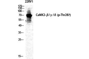Western Blot analysis of 22RV1 cells using Phospho-CaMKIIβ/γ/δ (T287) Polyclonal Antibody diluted at 1:500. (CaMKIIbeta/gamma/delta Antikörper  (pThr287))