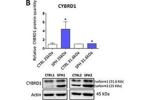 Expression of cytochrome b reductase (CYBRD1) and transferrin receptor 1 (TFR1) participating in iron uptake is higher in tumor-initiating cells (TICs)Expression of the CYBRD1 gene at the mRNA level in breast non-malignant cell line MCF10A, in TICs derived from breast cancer cell lines MCF-7, BT-474, T-47D and ZR-75-30 as well as from prostate cancer cell lines DU-145 and LNCaP has been determined (A) together with protein levels in the MCF-7 cell line (CTRL) and MCF-7 derived spheres (SPH) (B). (Cytochrome B Reductase 1 Antikörper  (AA 51-150))
