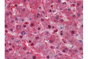 Immunohistochemical analysis of paraffin-embedded human Liver tissues using LPA mouse mAb (Lp(a) Antikörper)