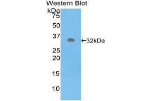 Detection of recombinant PCK1 using Polyclonal Antibody to Phosphoenolpyruvate Carboxykinase 1, Soluble (PCK1) (PCK1 Antikörper  (AA 311-558))