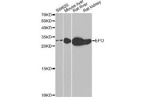 Western blot analysis of extracts of various cell lines, using EPO antibody (ABIN5973306) at 1/500 dilution. (EPO Antikörper)