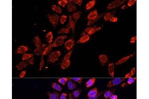Immunofluorescence analysis of NIH/3T3 cells using EIF4EBP1 Polyclonal Antibody at dilution of 1:100. (eIF4EBP1 Antikörper)