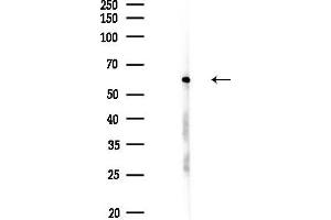 Western blot analysis of lysates from EC304 cells(UV,30 min treatment), using SNRP70 Antibody at 1/1000 dilution. (SNRNP70 Antikörper  (Internal Region))