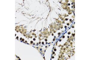 Immunohistochemistry of paraffin-embedded rat testis using DDX41 antibody (ABIN5973951) at dilution of 1/100 (40x lens). (DDX41 Antikörper)