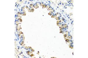 Immunohistochemistry of paraffin-embedded mouse lung using GNRH2 antibody (ABIN5974680) at dilution of 1/100 (40x lens). (GnRH2 Antikörper)