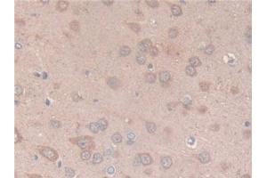 Detection of CS in Rat Brain Tissue using Polyclonal Antibody to Citrate Synthase (CS) (CS Antikörper  (AA 56-312))