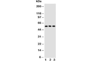 Western blot testing of GLUT5 antibody and Lane 1:  rat kidney;  2: rat liver;  3: mouse kidney tissue lysate (SLC2A5 Antikörper  (Middle Region))