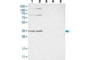 Western blot analysis of Lane 1: RT-4, Lane 2: U-251 MG, Lane 3: Human Plasma, Lane 4: Liver, Lane 5: Tonsil with WRNIP1 polyclonal antibody  at 1:250-1:500 dilution.