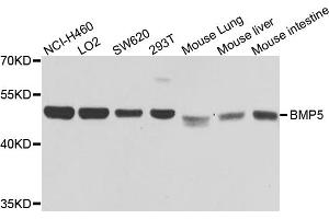Western blot analysis of extracts of various cell lines, using BMP5 antibody. (BMP5 Antikörper)