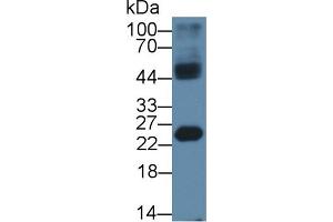 Western Blot; Sample: Mouse Testis lysate; Primary Ab: 1µg/ml Rabbit Anti-Human HMGB4 Antibody Second Ab: 0. (HMGB4 Antikörper  (AA 25-167))