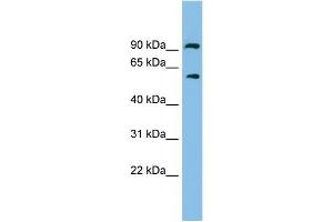 WB Suggested Anti-ALDH7A1 Antibody Titration: 0. (ALDH7A1 Antikörper  (N-Term))