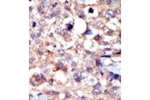 Image no. 2 for anti-C-Abl Oncogene 1, Non-Receptor tyrosine Kinase (ABL1) (C-Term) antibody (ABIN359966) (ABL1 Antikörper  (C-Term))