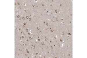 Immunohistochemical staining of human hippocampus with PPP2R3A polyclonal antibody  shows moderate cytoplasmic positivity in neuronal cells at 1:200-1:500 dilution. (PPP2R3A Antikörper)
