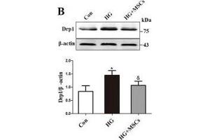 MSCs attenuate HG-induced mitochondrial dysfunction. (beta Actin Antikörper  (AA 1-375))