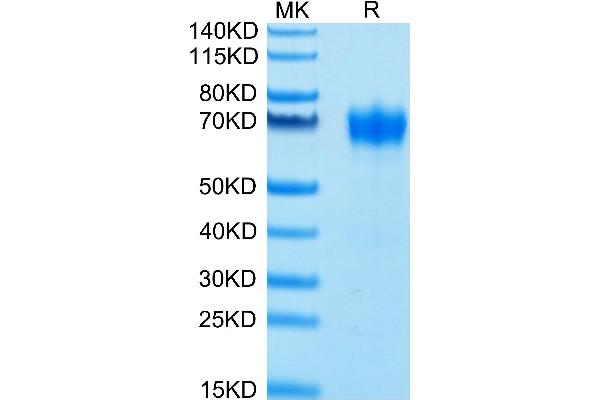 CSF2RA Protein (His-Avi Tag,Biotin)