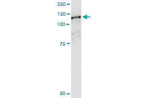 Immunoprecipitation of HIP1R transfected lysate using anti-HIP1R MaxPab rabbit polyclonal antibody and Protein A Magnetic Bead , and immunoblotted with HIP1R purified MaxPab mouse polyclonal antibody (B01P) . (HIP1R Antikörper  (AA 1-1068))
