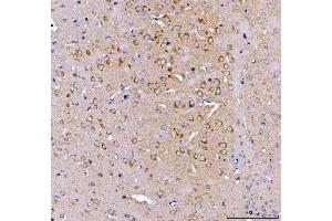 IHC analysis of SRGAP3 using anti-SRGAP3 antibody (ABIN7602538). (SRGAP3 Antikörper  (AA 824-1067))