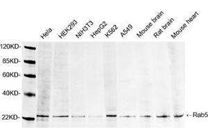 Western blot analysis of lysates using 1 µg/mL Rabbit Anti-Rab5 Polyclonal Antibody (ABIN398815) The signal was developed with IRDyeTM 800 Conjugated Goat Anti-Rabbit IgG. (RAB5 Antikörper  (AA 150-200))