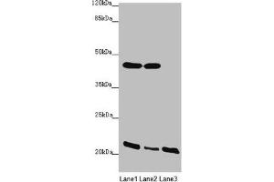 Western blot All lanes: ZDHHC16 antibody at 1.